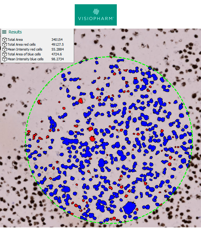 Analysis Vis