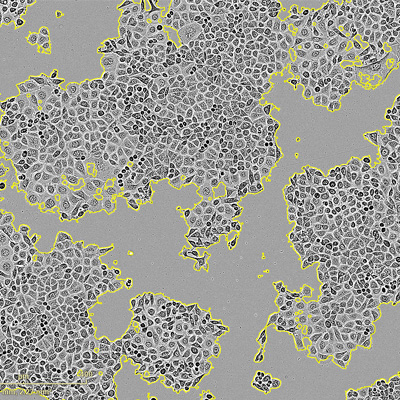 Incucyte Confluency assay