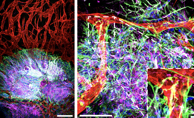 Brain Organoid