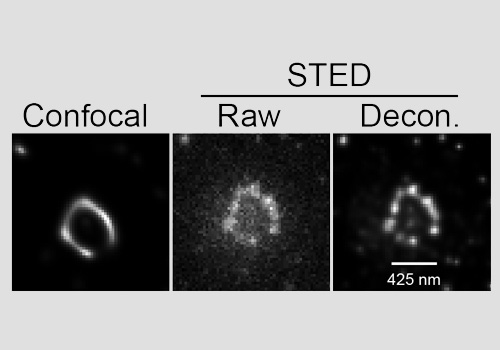 ANKRD26 in RPE-1 cells using STEDYCON